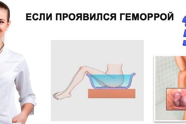 Замена hydra