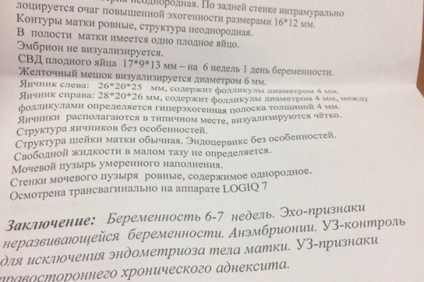 Через какой браузер заходить на кракен
